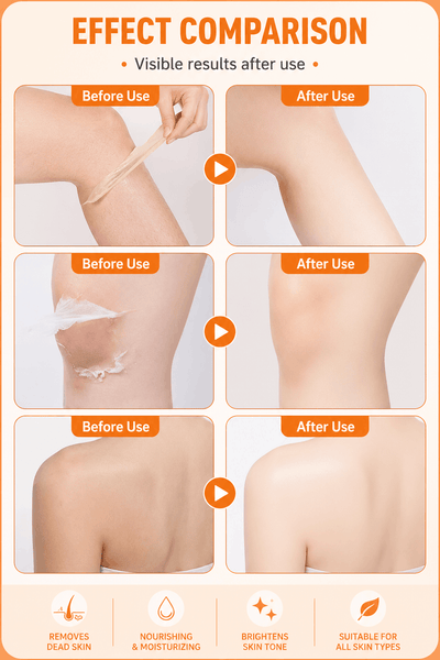 An infographic comparison graphic titled 'EFFECT COMPARISON' showing four panels of skin before and after use, demonstrating the removal of dead skin and a whitish patch on a leg and shoulder. The graphic includes orange text and icons on a light peach background.